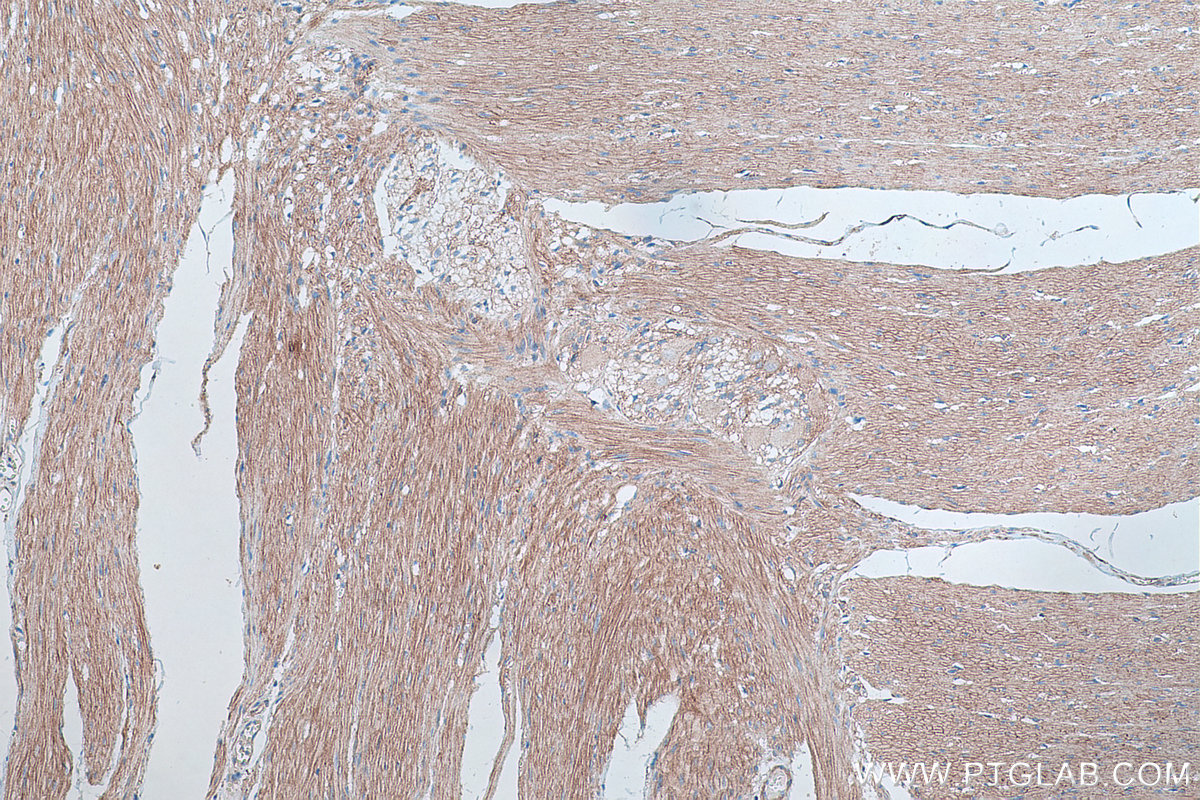 IHC staining of human colon using 66735-1-Ig (same clone as 66735-1-PBS)