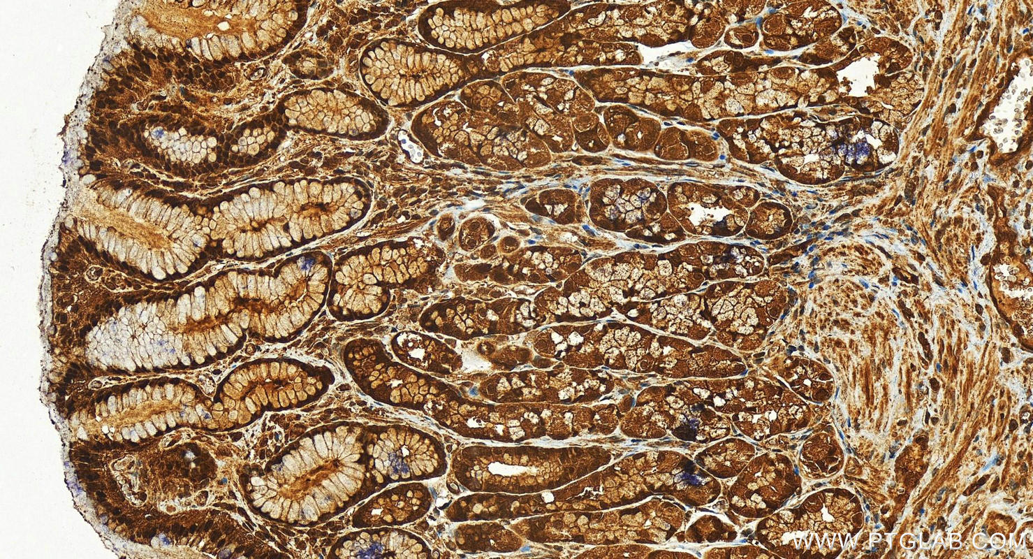 IHC staining of human stomach using 12224-1-AP