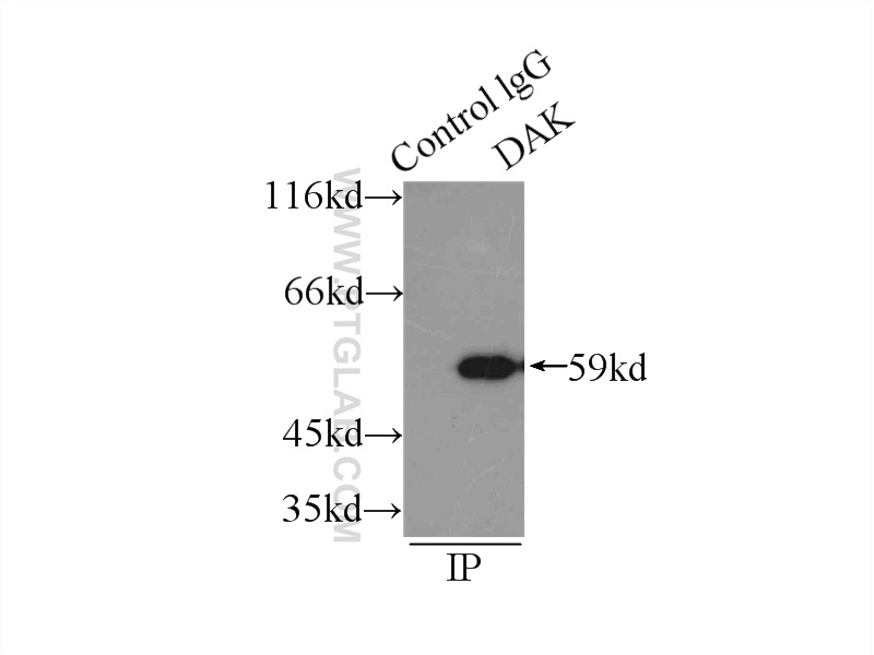 IP experiment of HeLa using 12224-1-AP