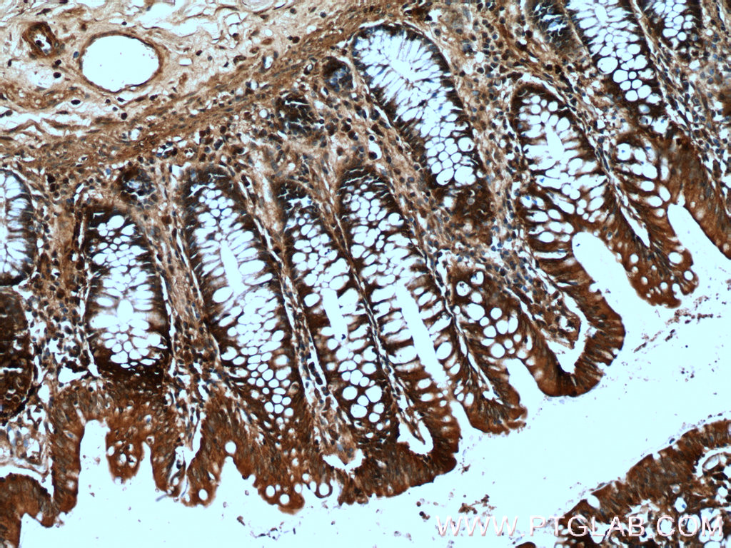 IHC staining of human colon using 13273-1-AP