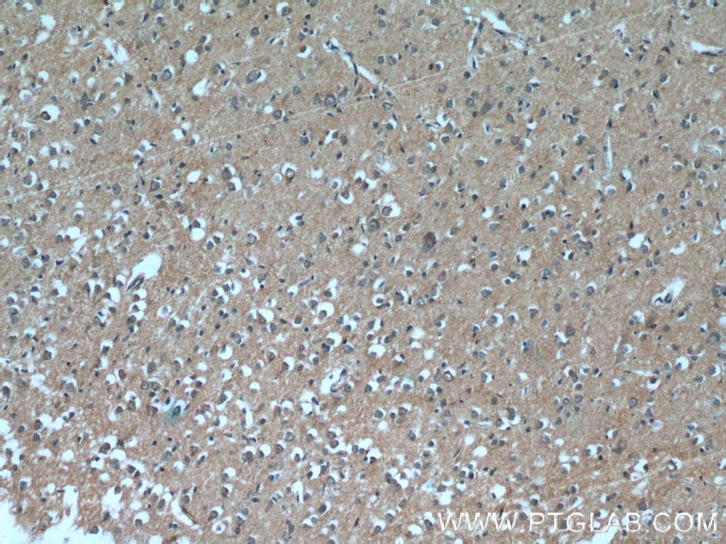 IHC staining of human brain using 24692-1-AP