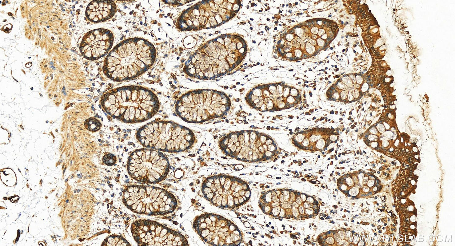 IHC staining of human colon using 10276-1-AP