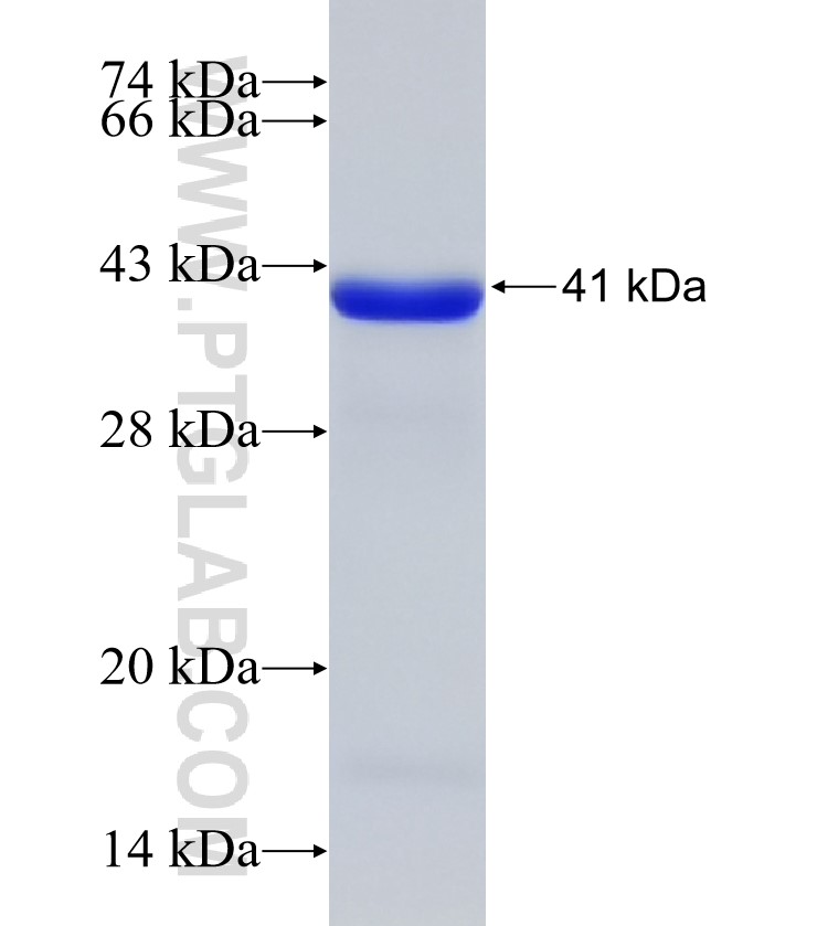 DAPK1 fusion protein Ag18387 SDS-PAGE