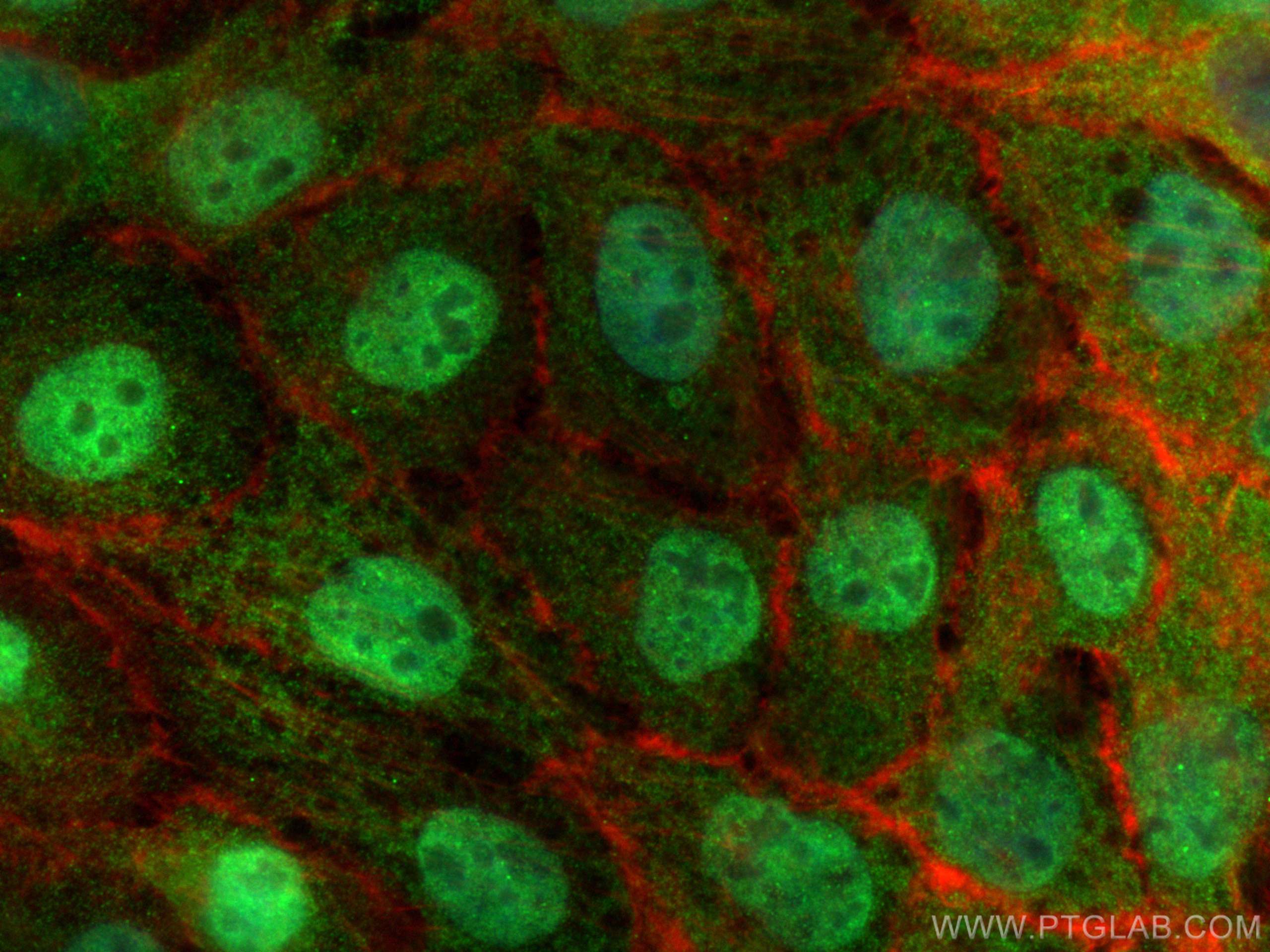 IF Staining of A431 using 30656-1-AP