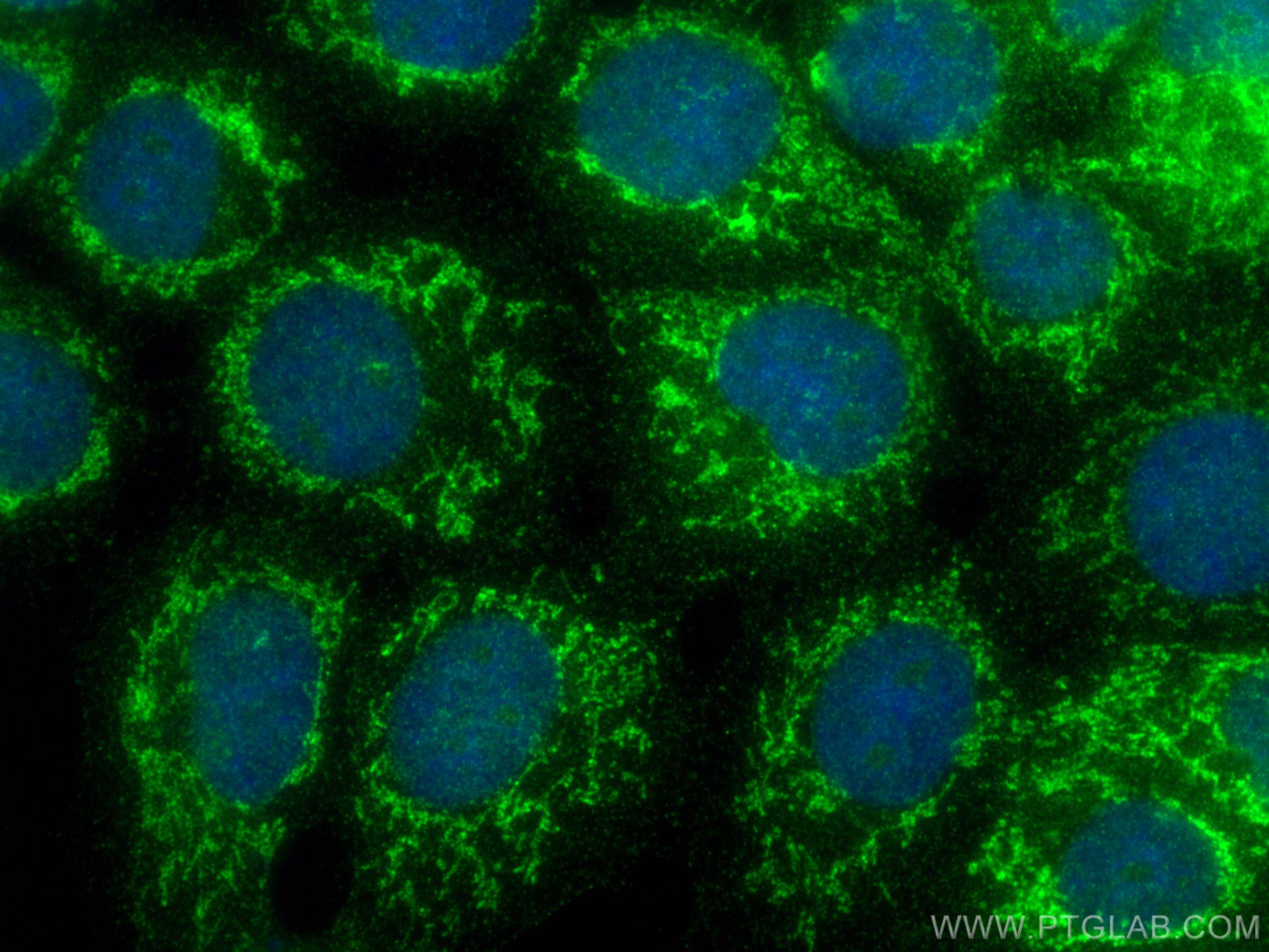 IF Staining of A431 using 13807-1-AP