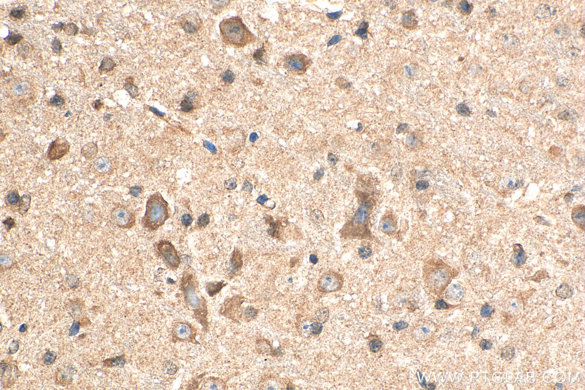 IHC staining of mouse cerebellum using 13807-1-AP