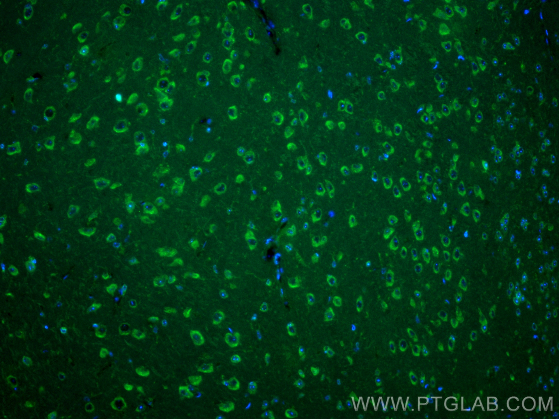 IF Staining of mouse brain using CL488-22524