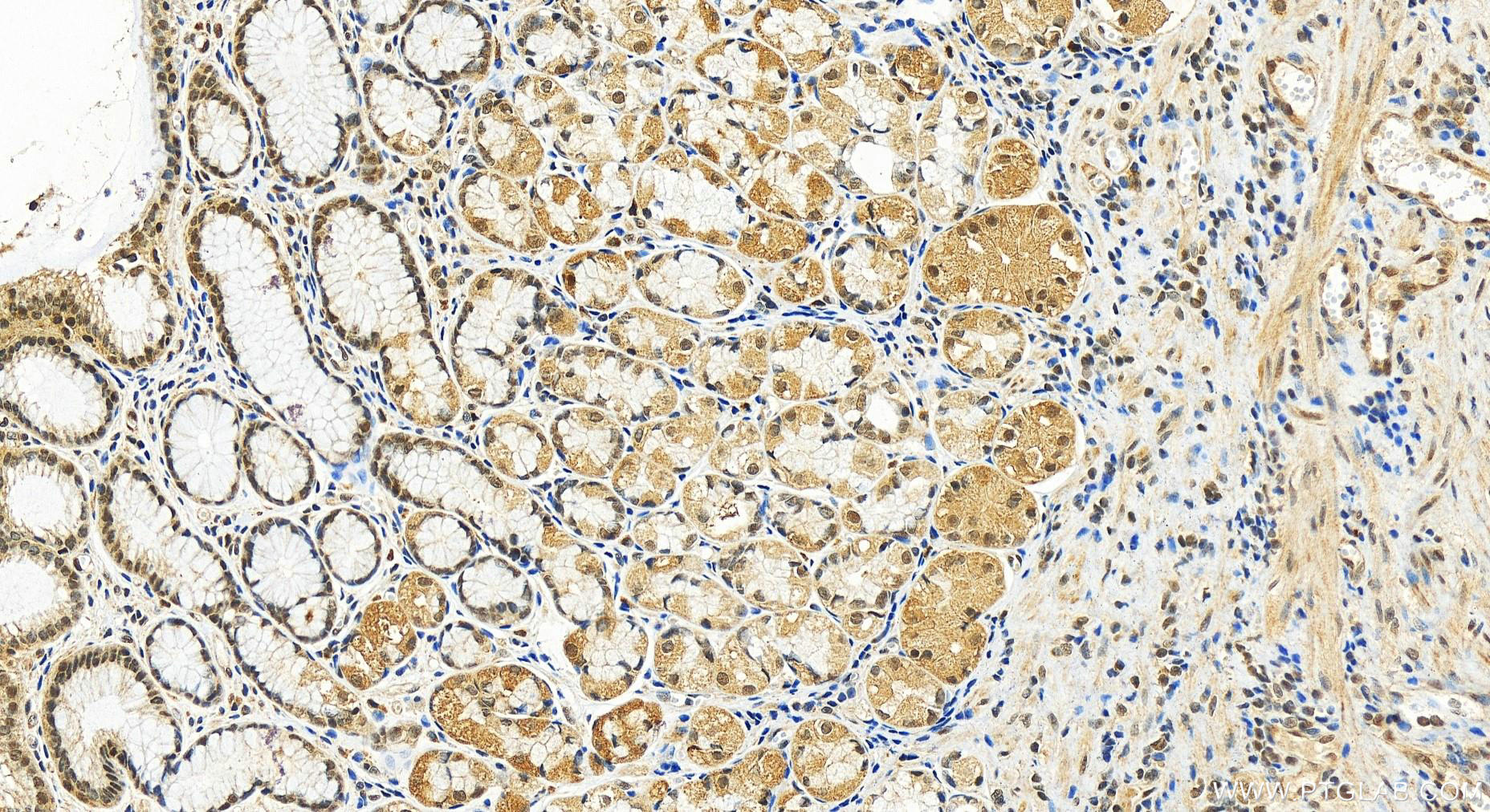 IHC staining of human stomach using 20489-1-AP