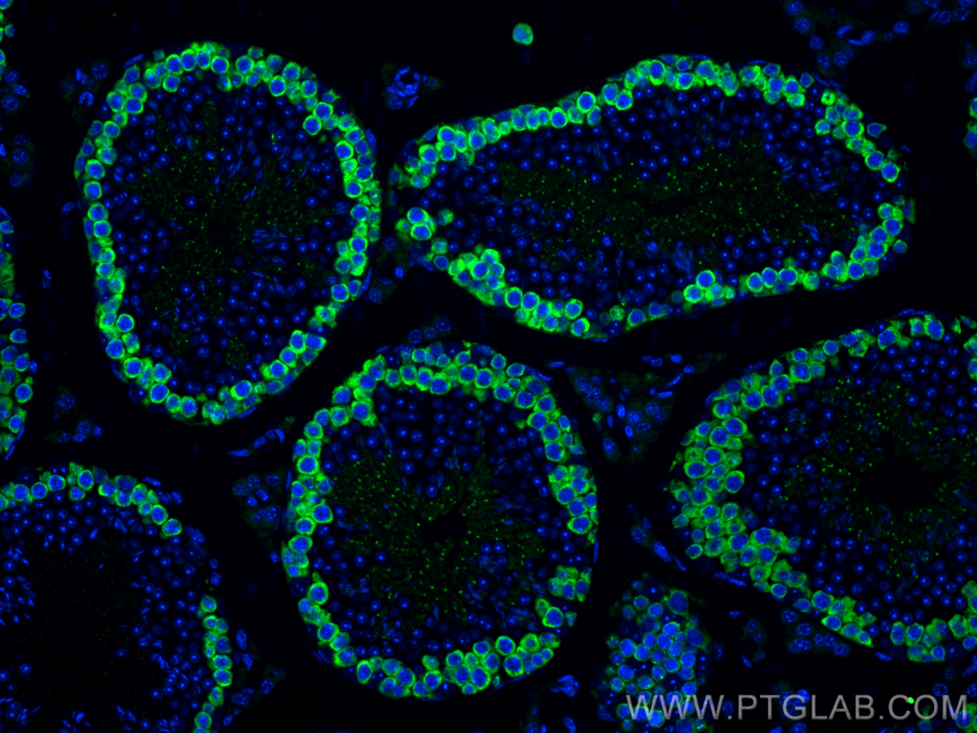 IF Staining of mouse testis using 12633-1-AP