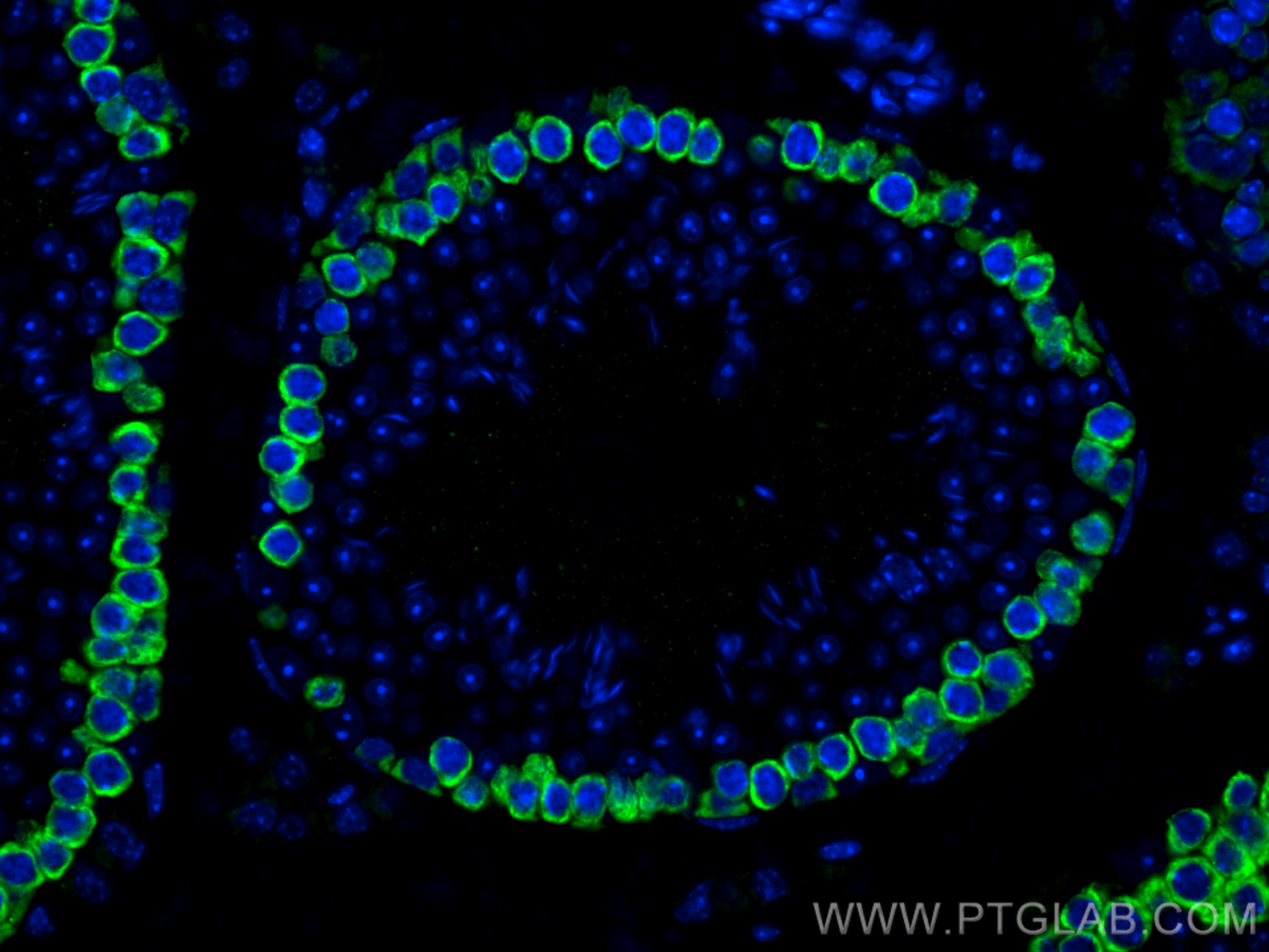 IF Staining of mouse testis using 12633-1-AP