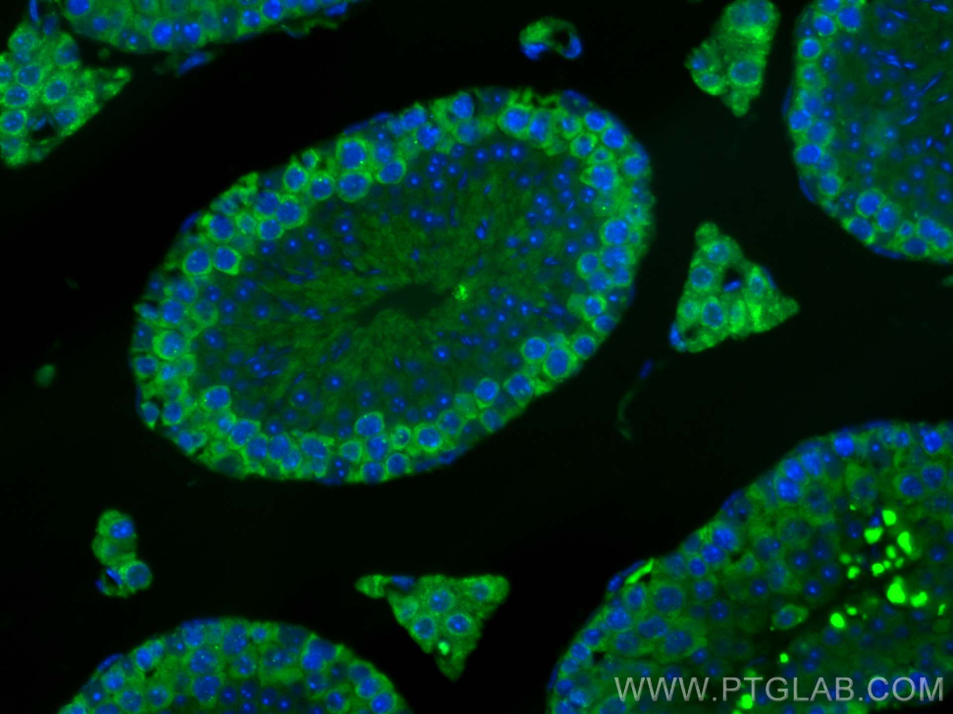 IF Staining of mouse testis using CL488-12633