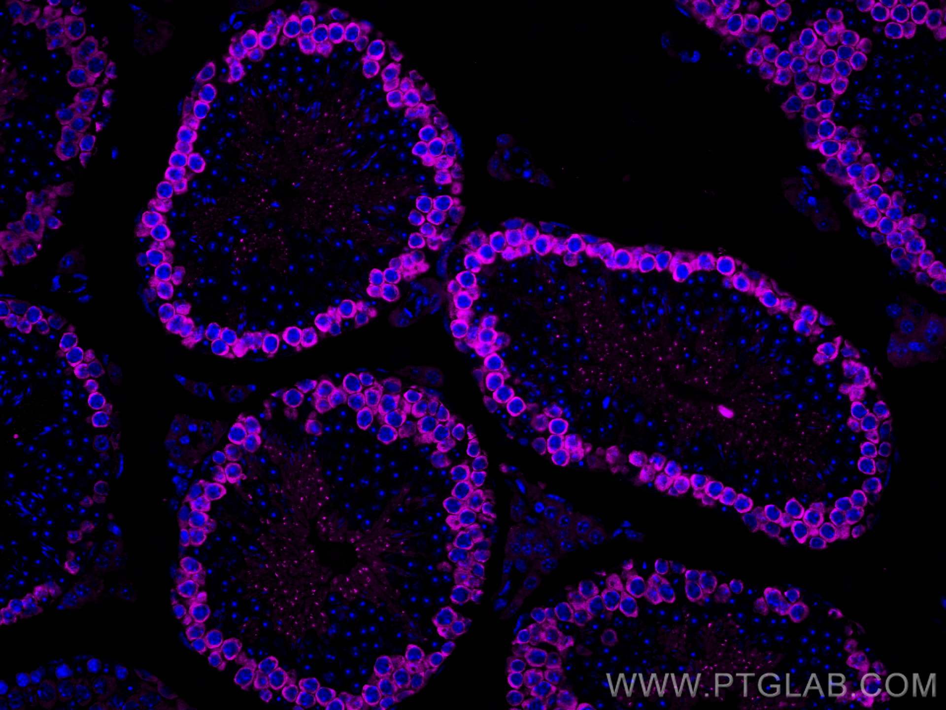 IF Staining of mouse testis using CL647-12633