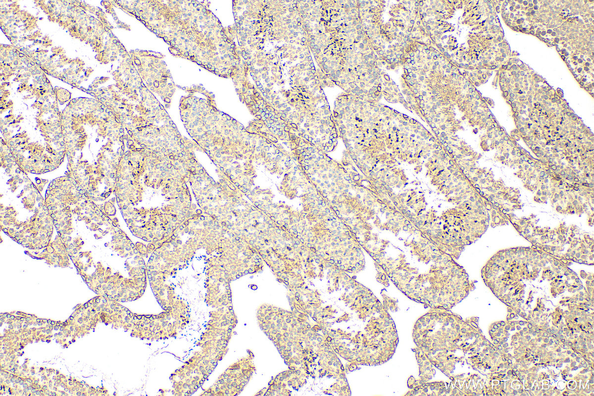 IHC staining of mouse testis using 10260-1-AP