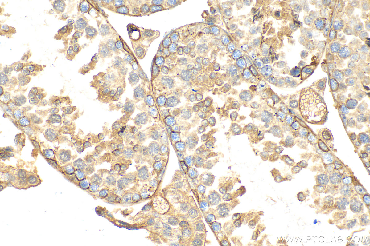 IHC staining of mouse testis using 10260-1-AP