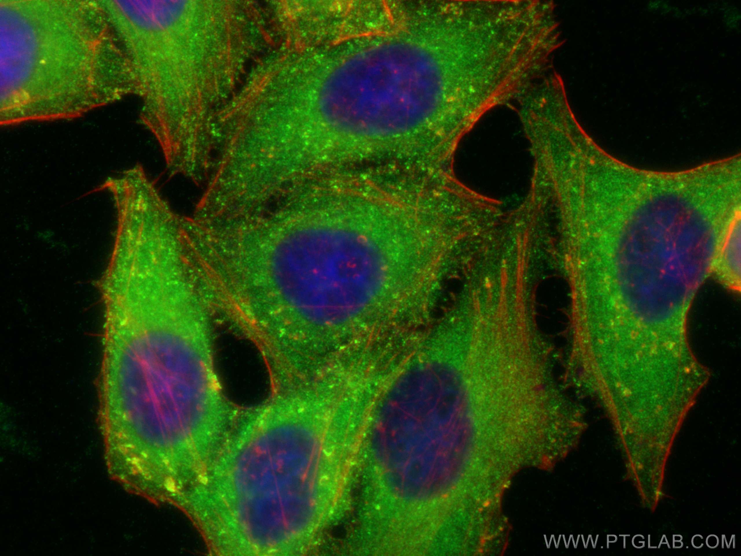 IF Staining of HepG2 using 13015-1-AP