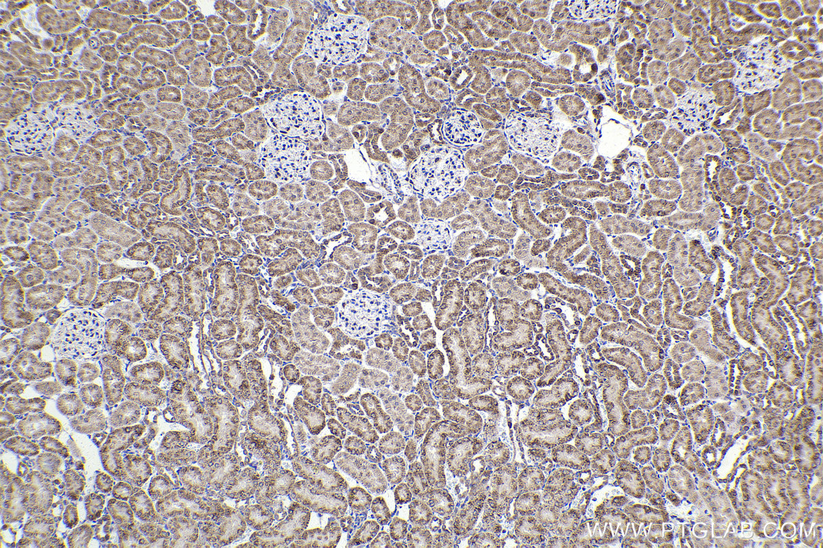 IHC staining of rat kidney using 12451-1-AP