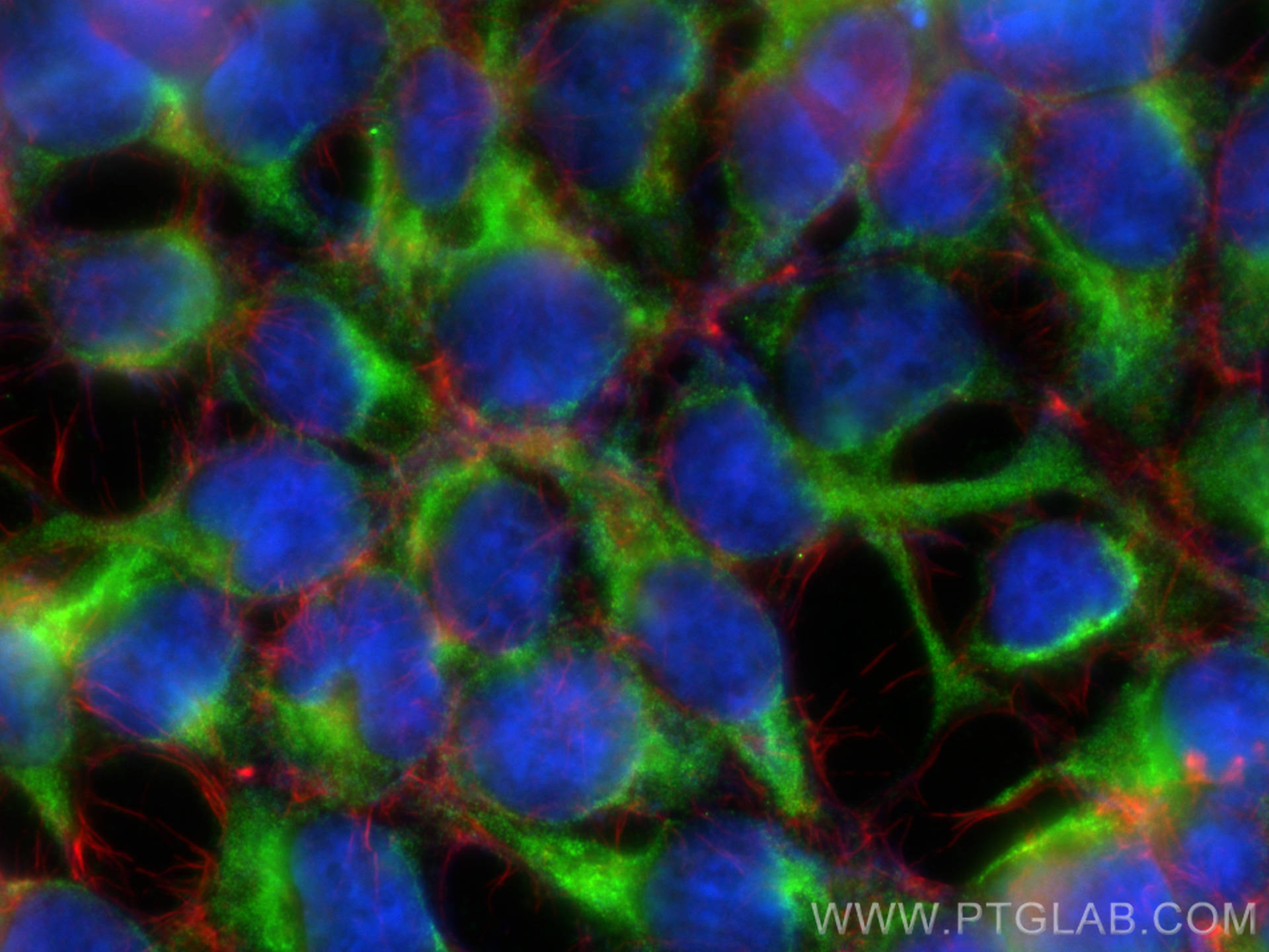 IF Staining of HEK-293 using 11535-1-AP