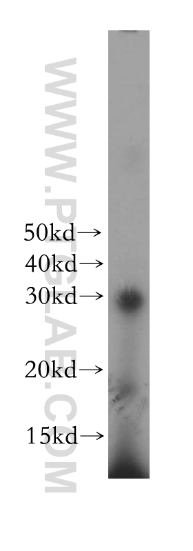 DCK Polyclonal antibody