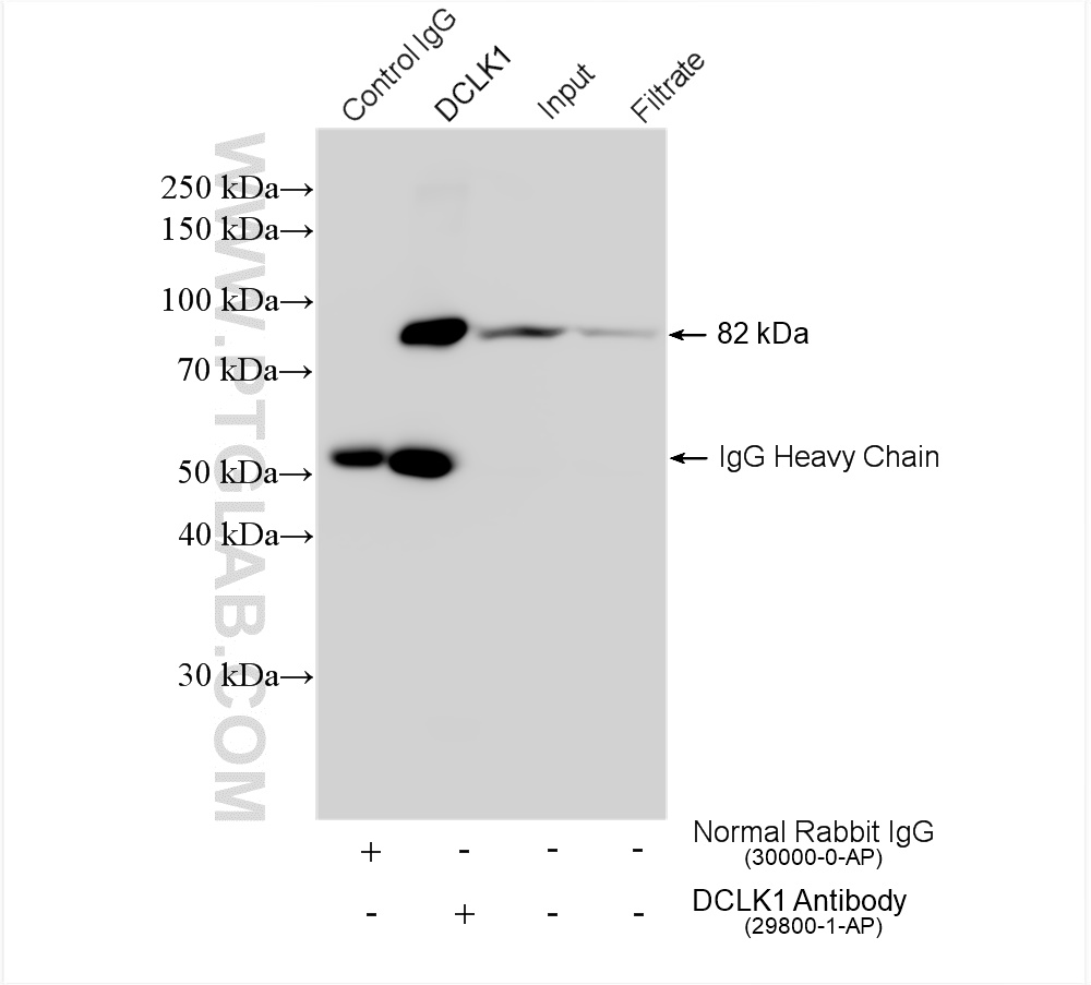 IP experiment of mouse brain using 29800-1-AP