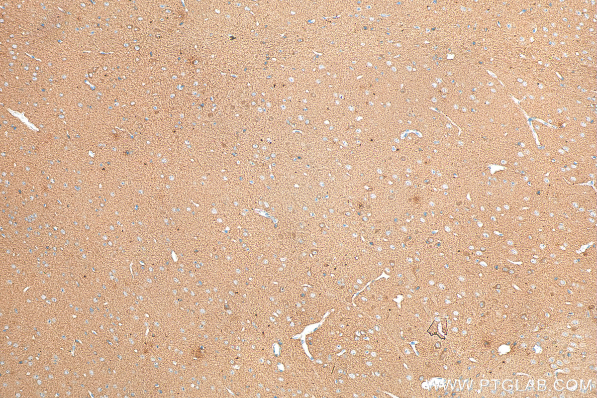 IHC staining of mouse brain using 68234-1-Ig (same clone as 68234-1-PBS)