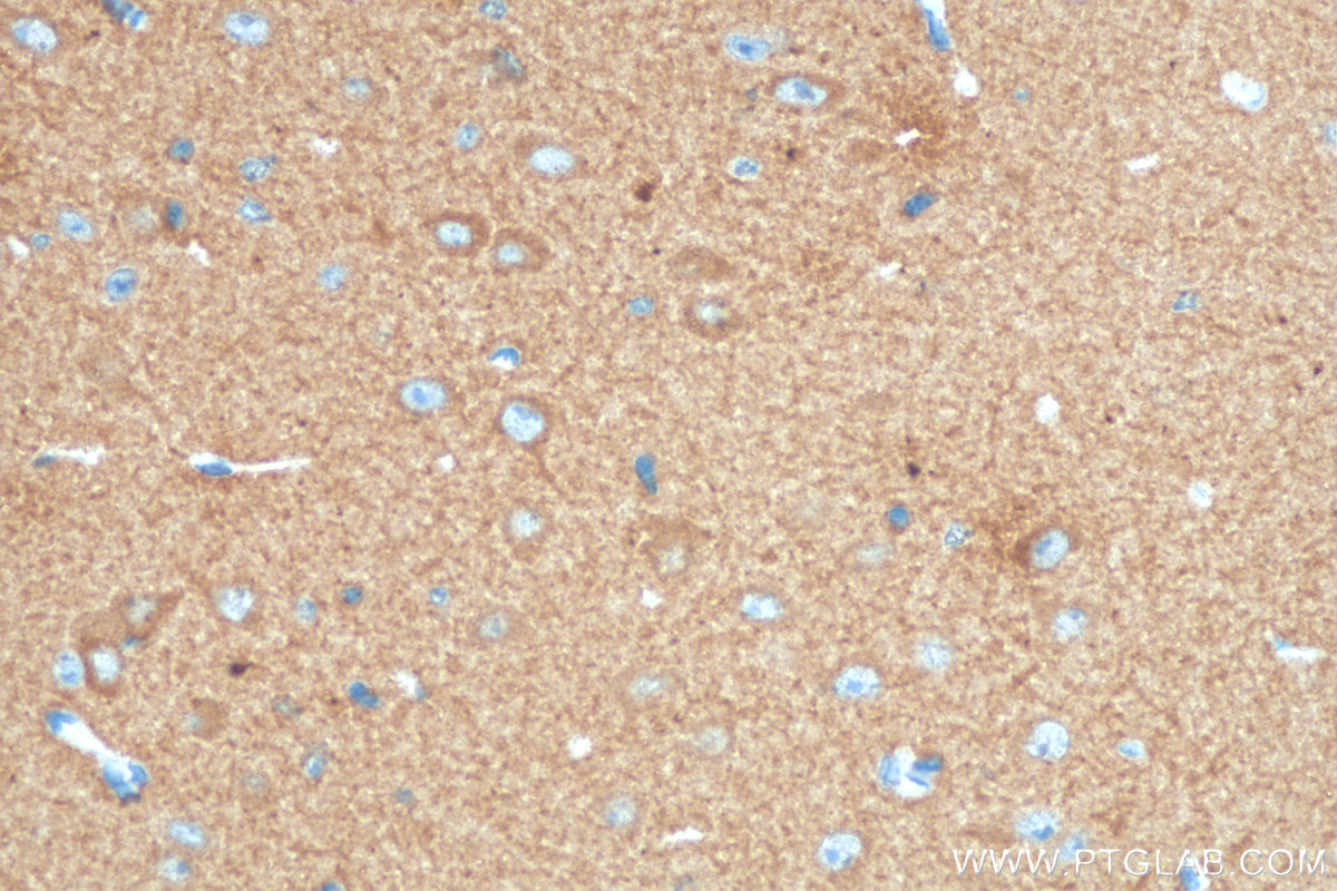 IHC staining of mouse brain using 68234-1-Ig (same clone as 68234-1-PBS)