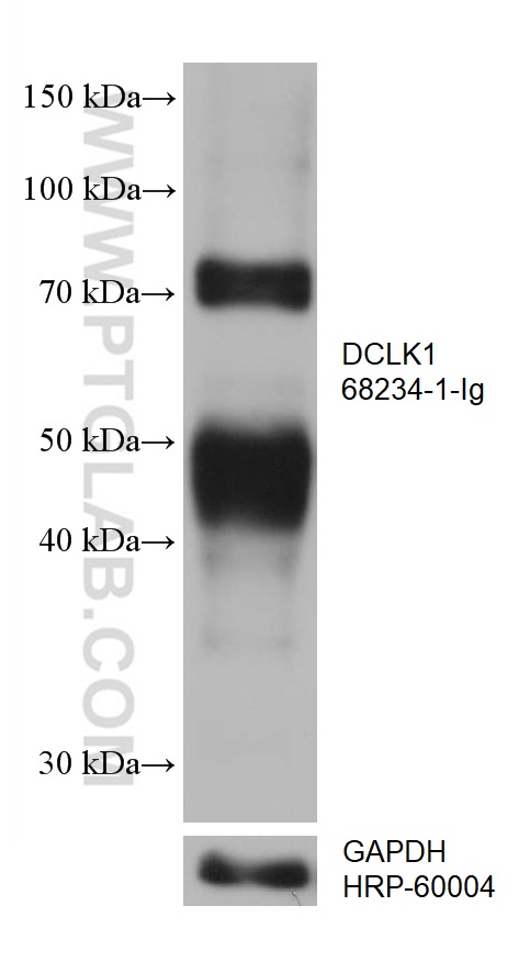 WB analysis of fetal human brain using 68234-1-Ig (same clone as 68234-1-PBS)