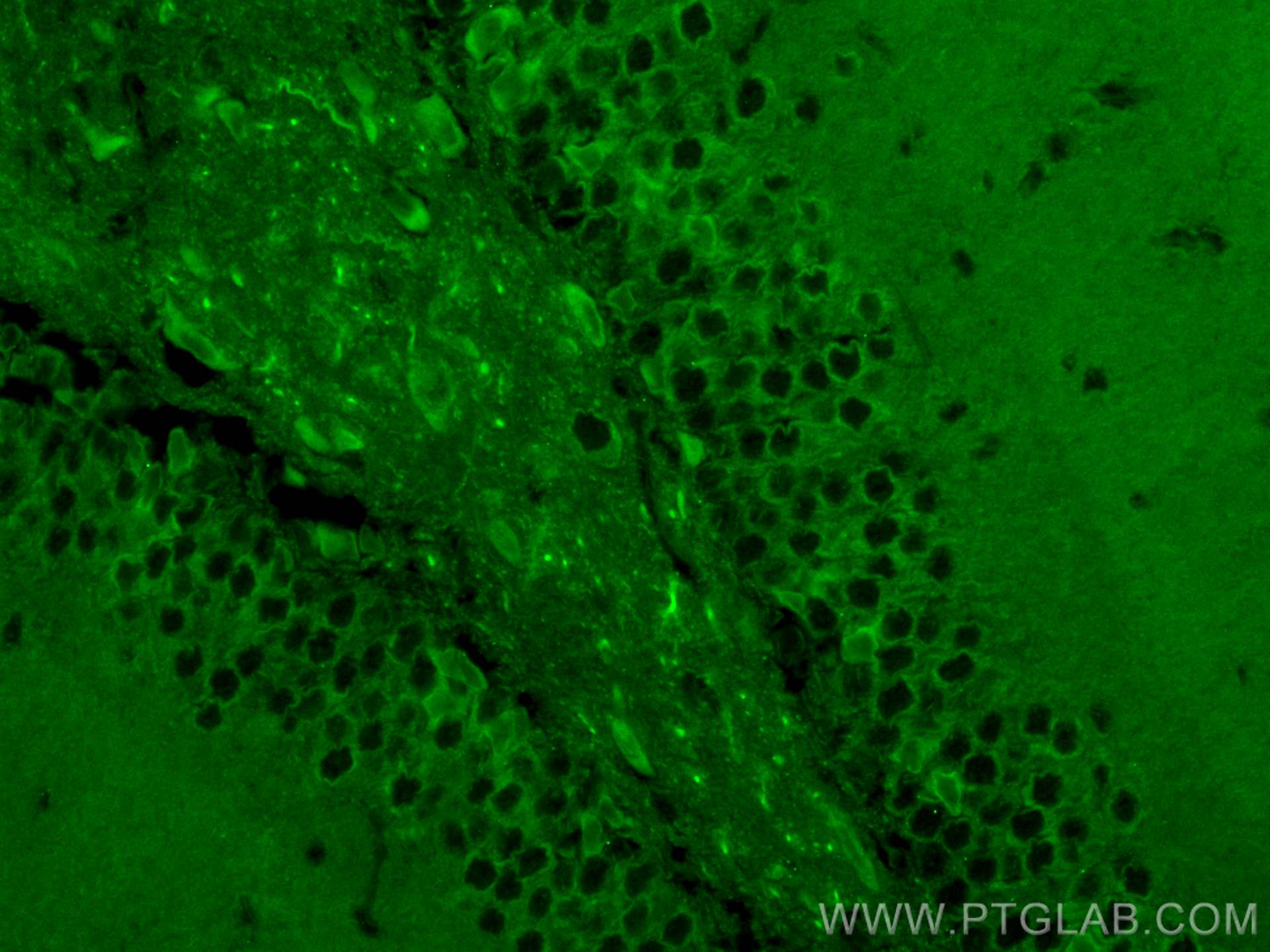 IF Staining of mouse brain using CL488-29800