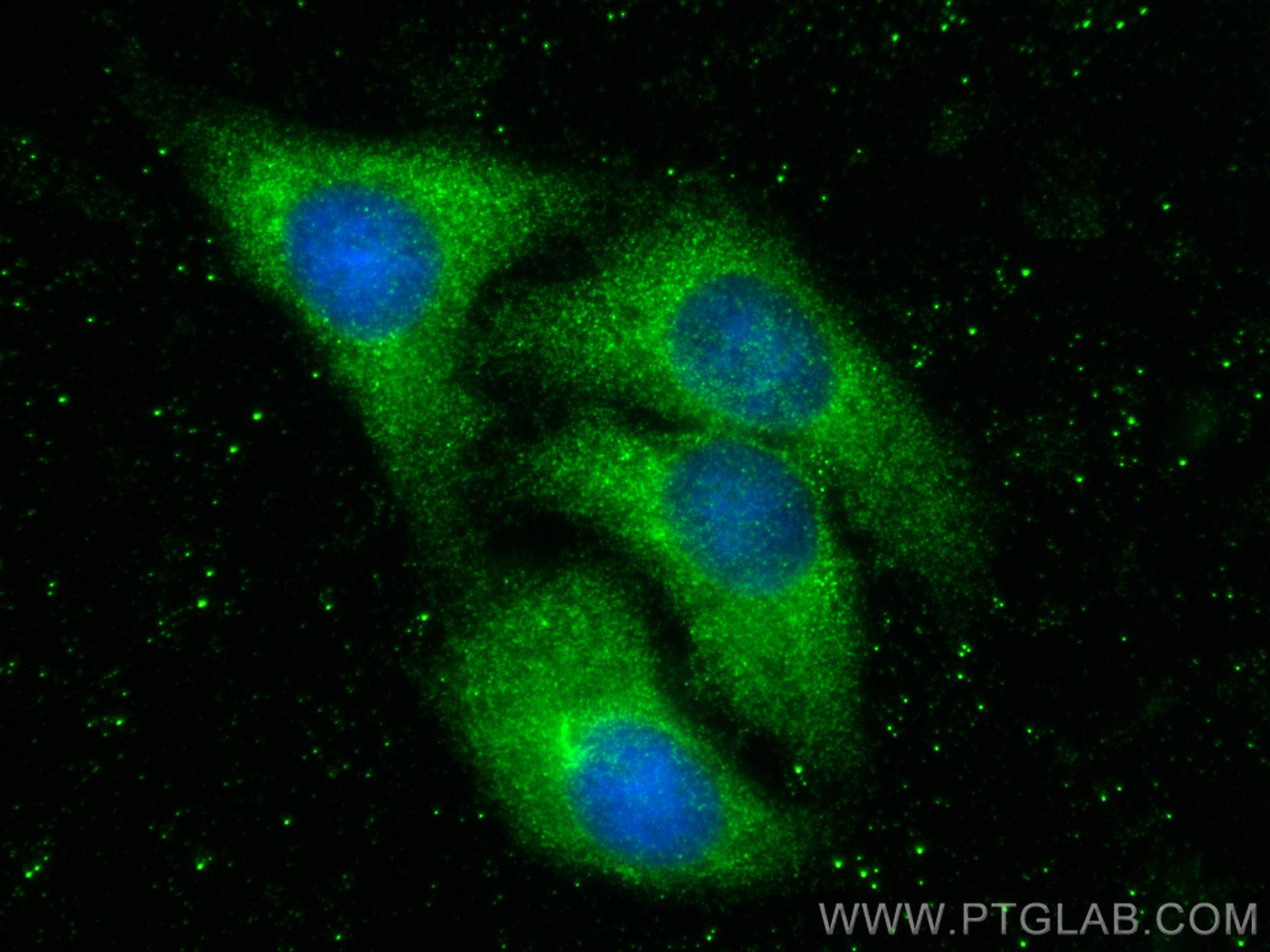 IF Staining of HepG2 using 25450-1-AP