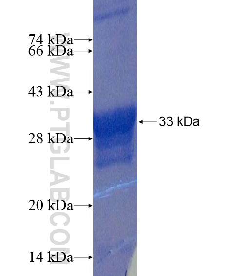DCLK2 fusion protein Ag22142 SDS-PAGE