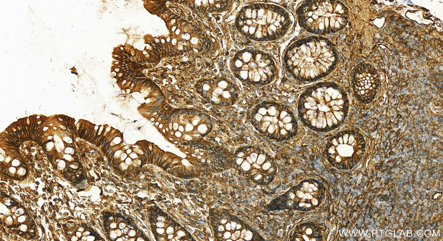 IHC staining of human normal colon using 14667-1-AP