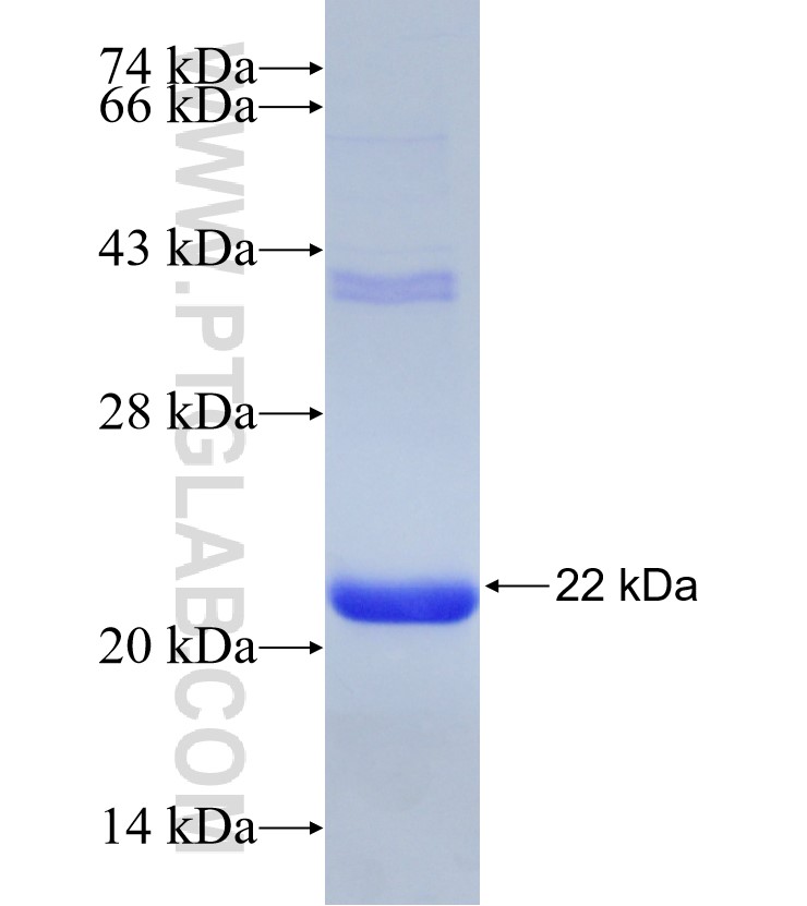 DCN fusion protein Ag30859 SDS-PAGE