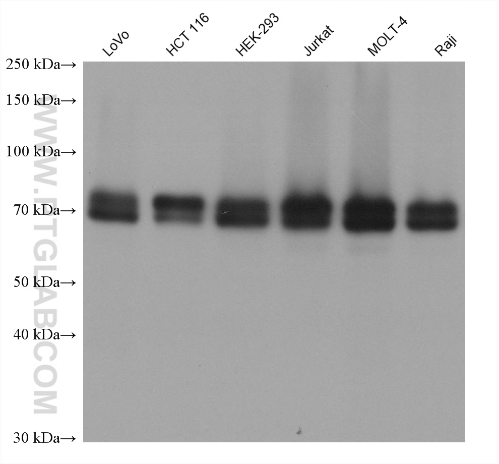 WB analysis using 60494-1-Ig