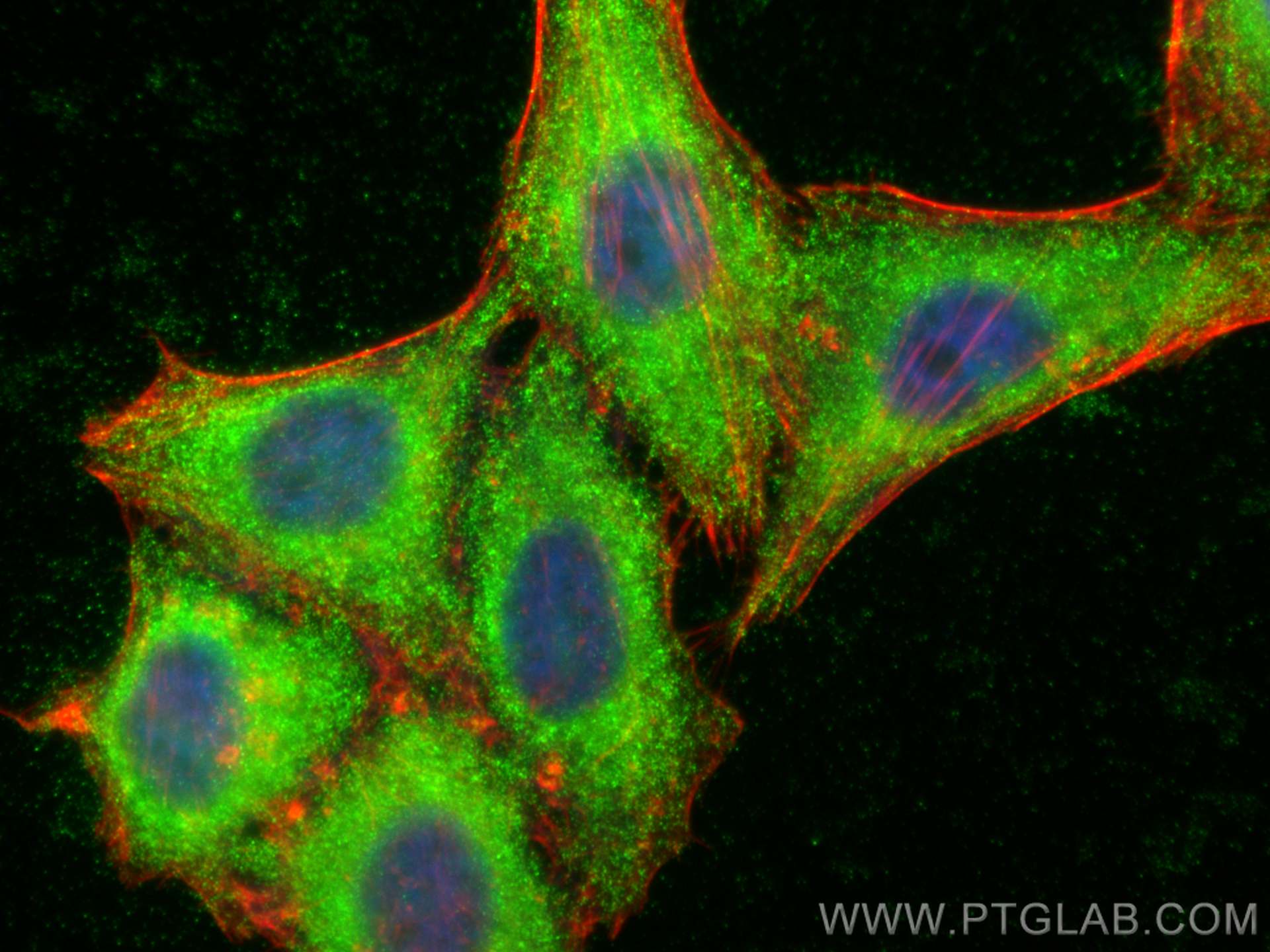 IF Staining of HepG2 using 16784-1-AP