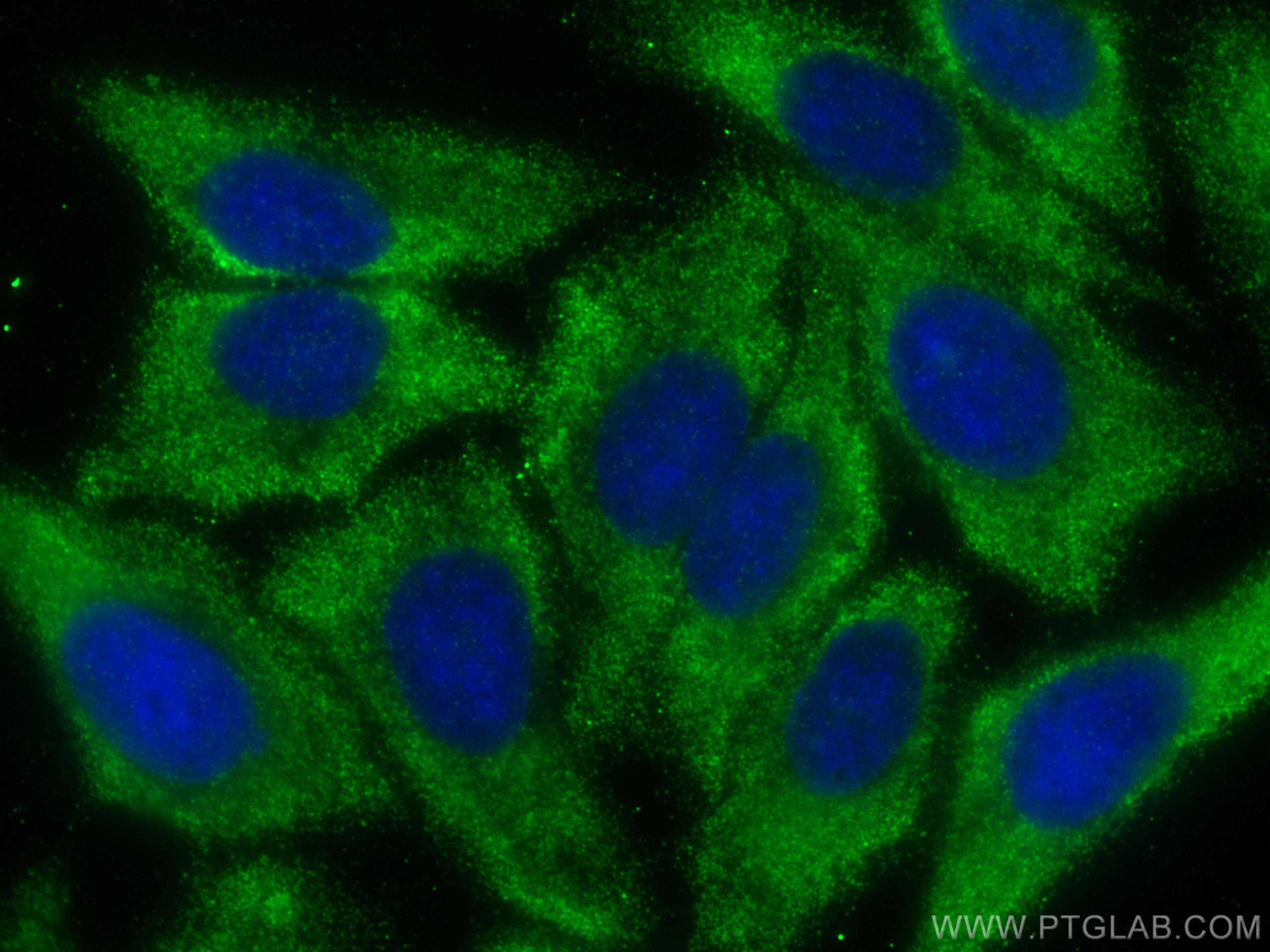 IF Staining of HepG2 using 68357-1-Ig (same clone as 68357-1-PBS)