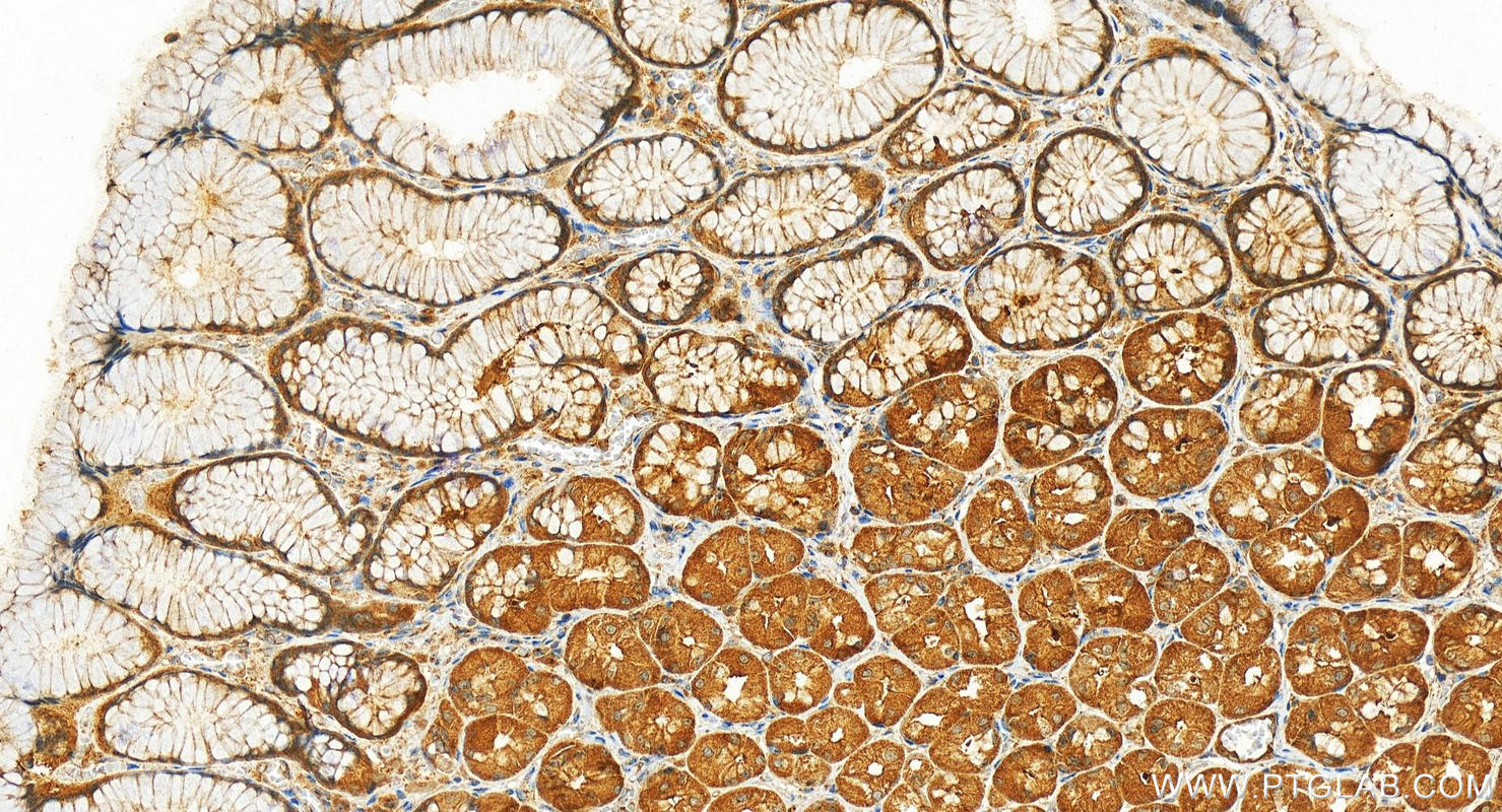 IHC staining of human stomach using 17098-1-AP