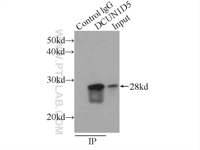 IP experiment of HeLa using 14810-1-AP