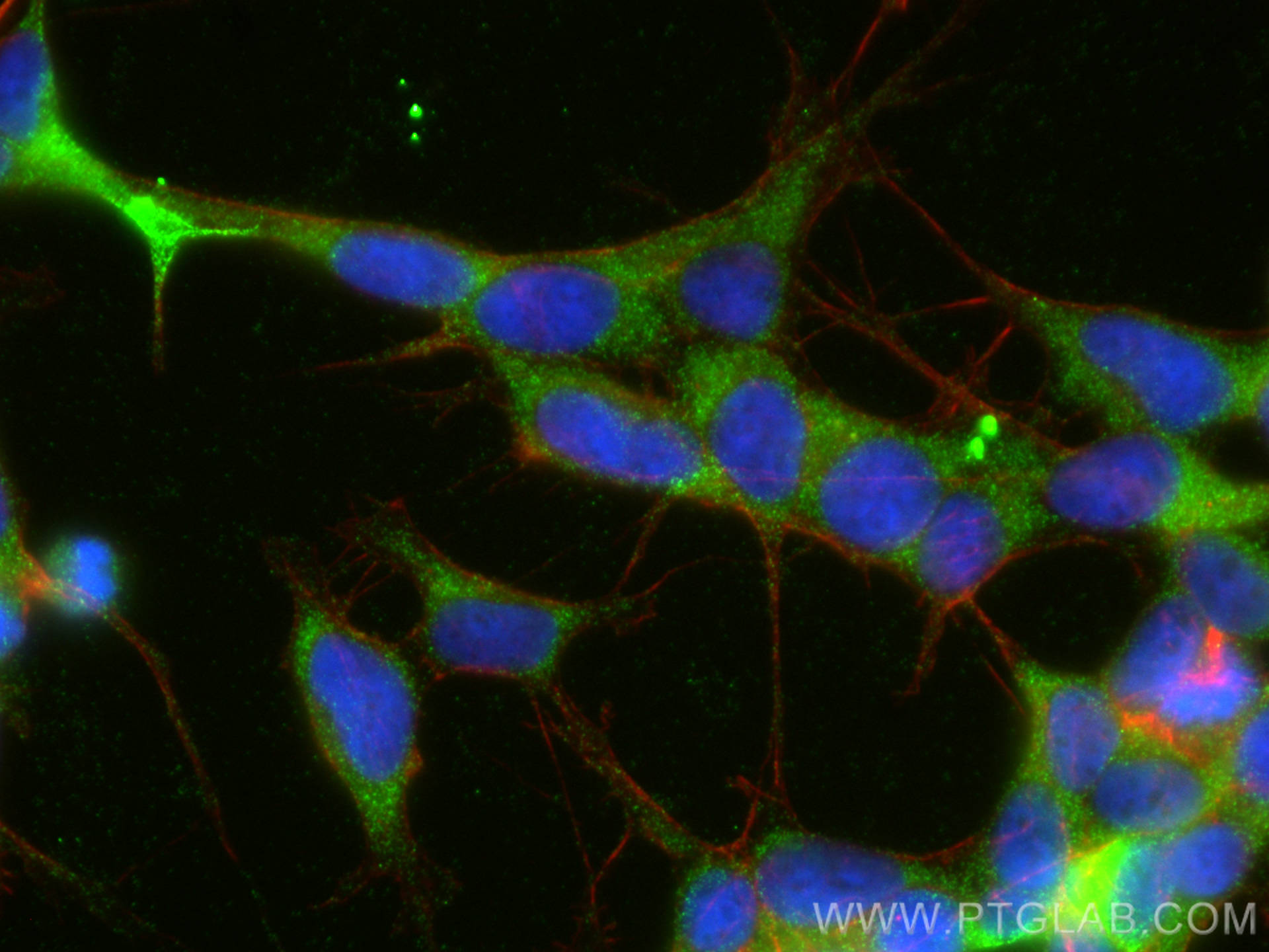 IF Staining of SH-SY5Y using 13925-1-AP