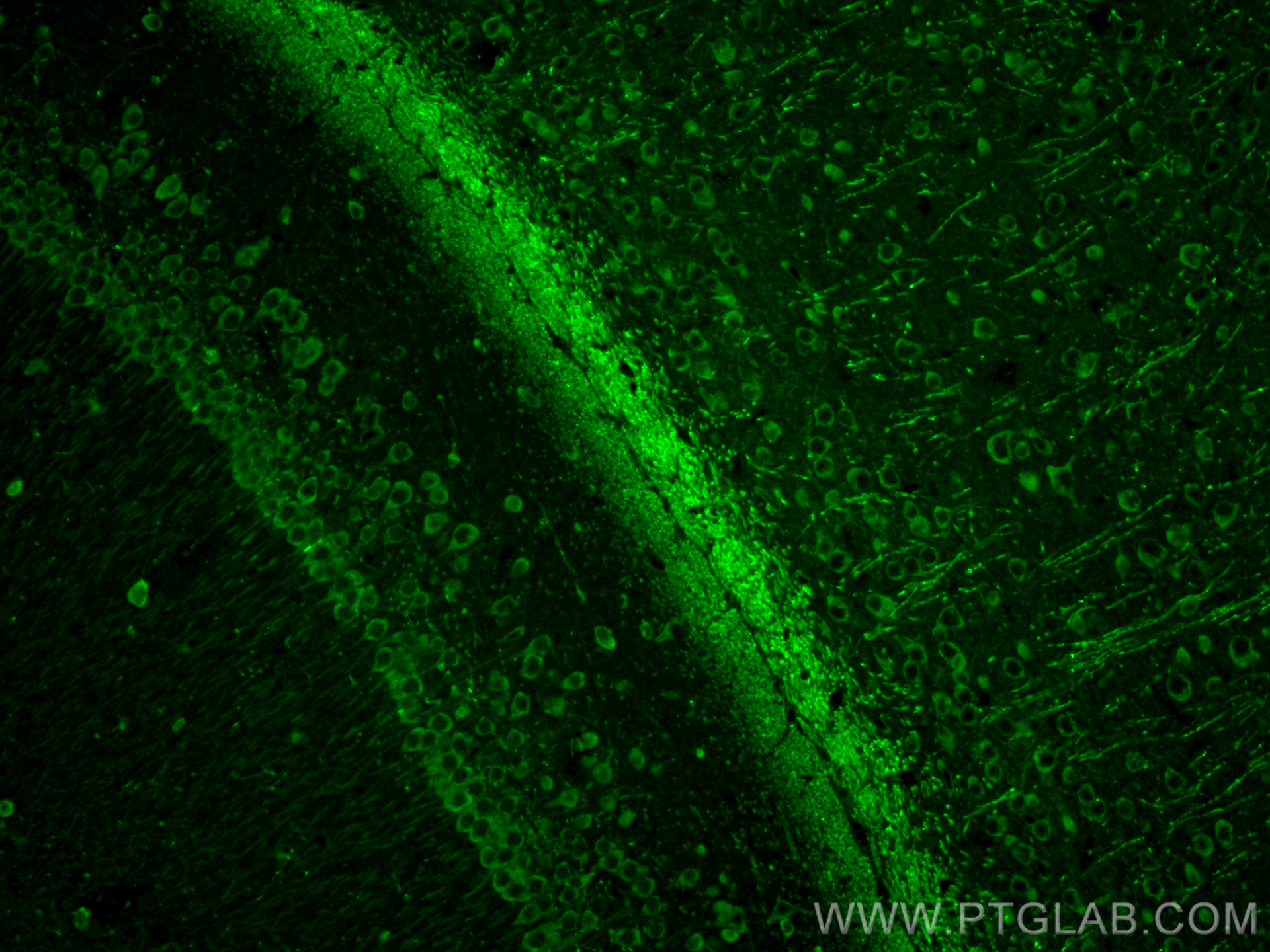 IF Staining of mouse brain using 13925-1-AP