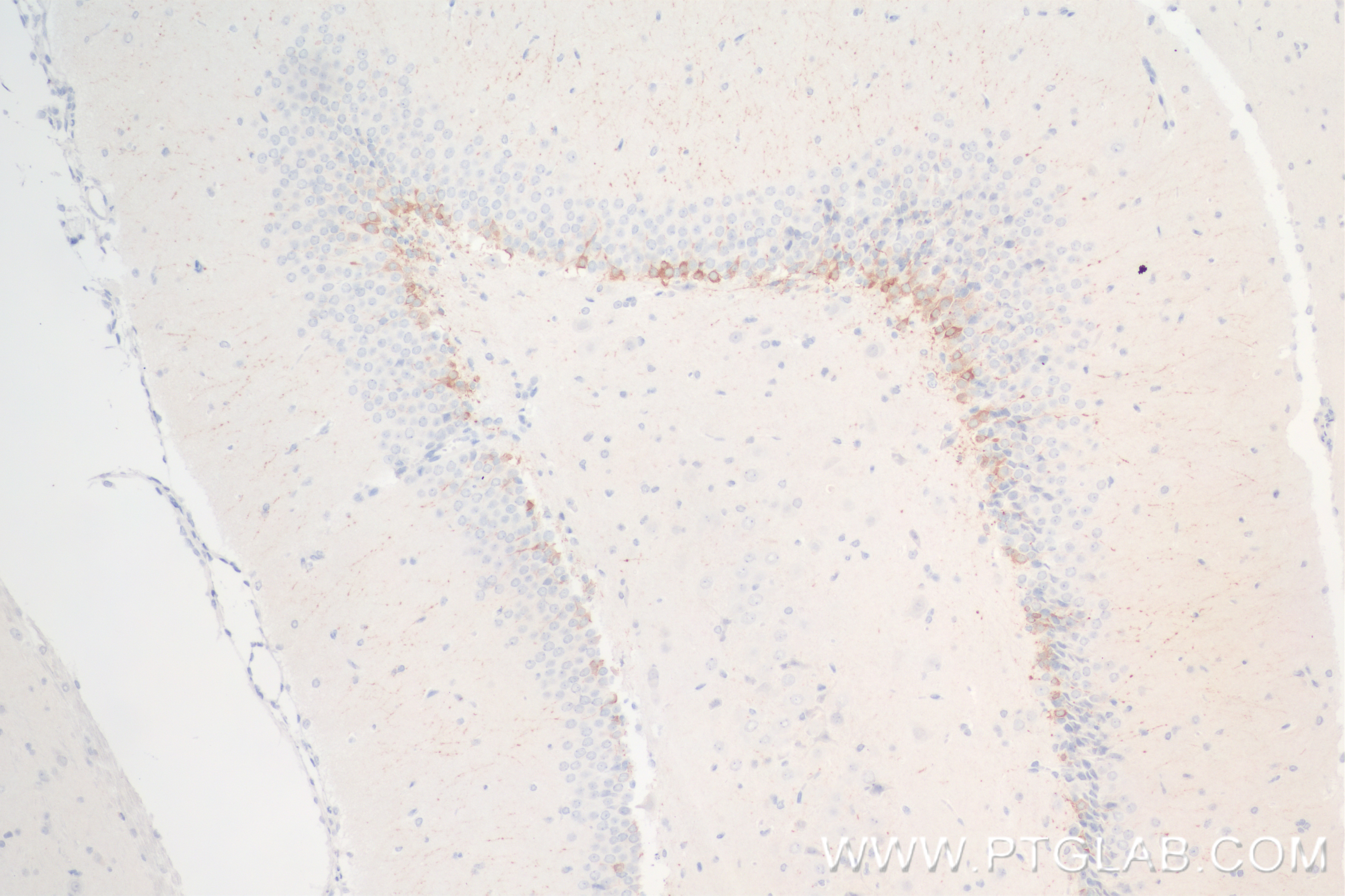 IHC staining of rat brain using 84595-4-RR