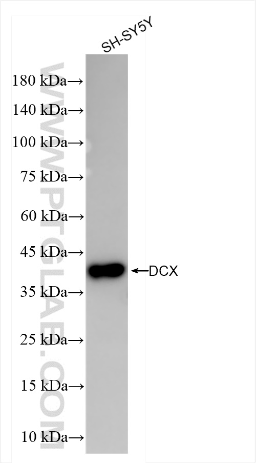 WB analysis of SH-SY5Y using 84595-4-RR