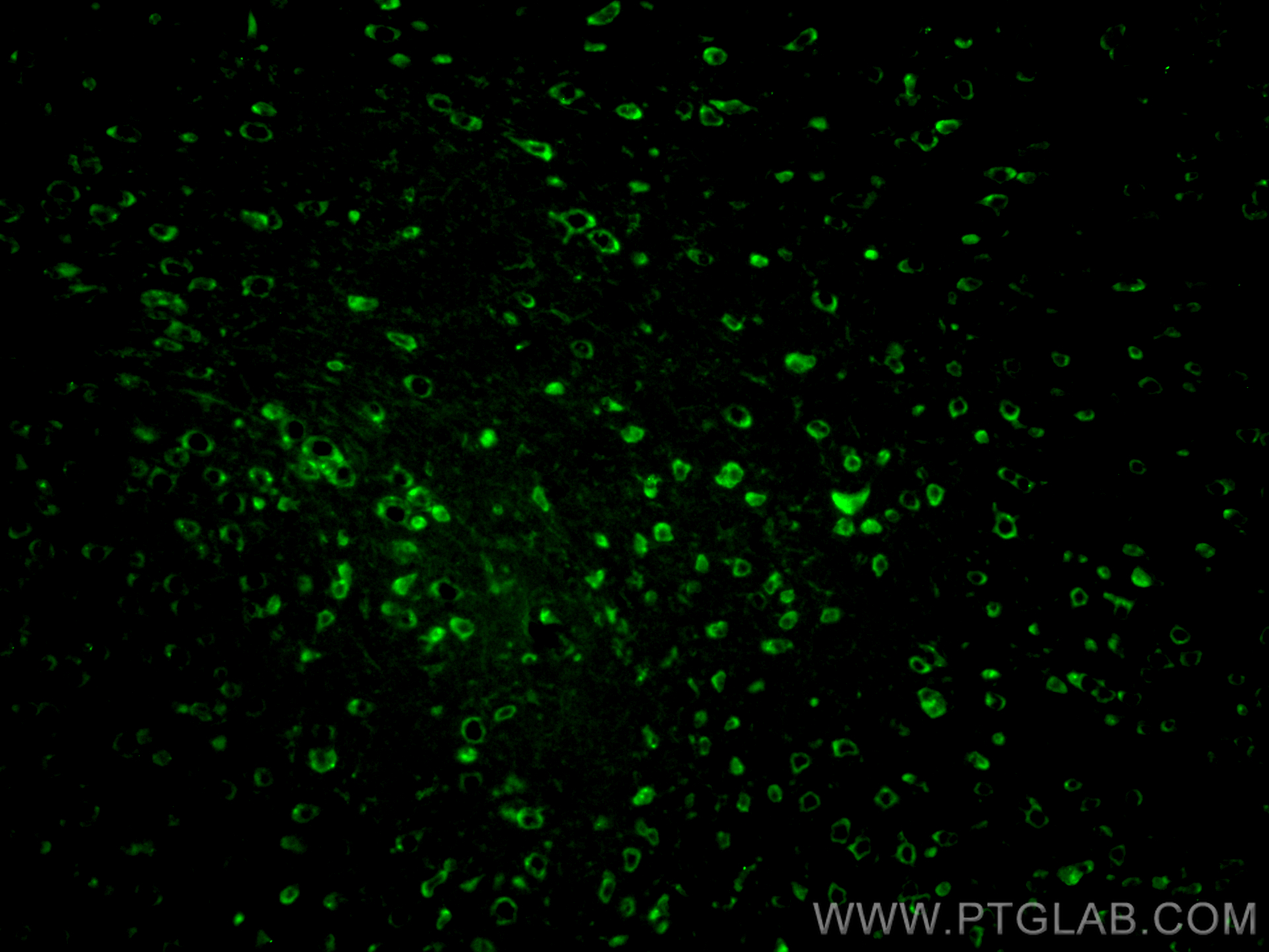 IF Staining of mouse brain using CL488-13925