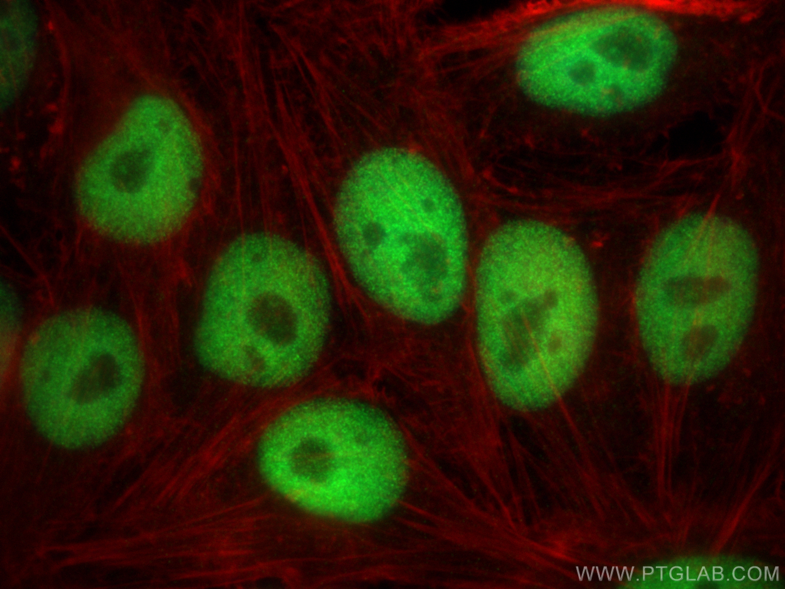 IF Staining of HepG2 using 14995-1-AP