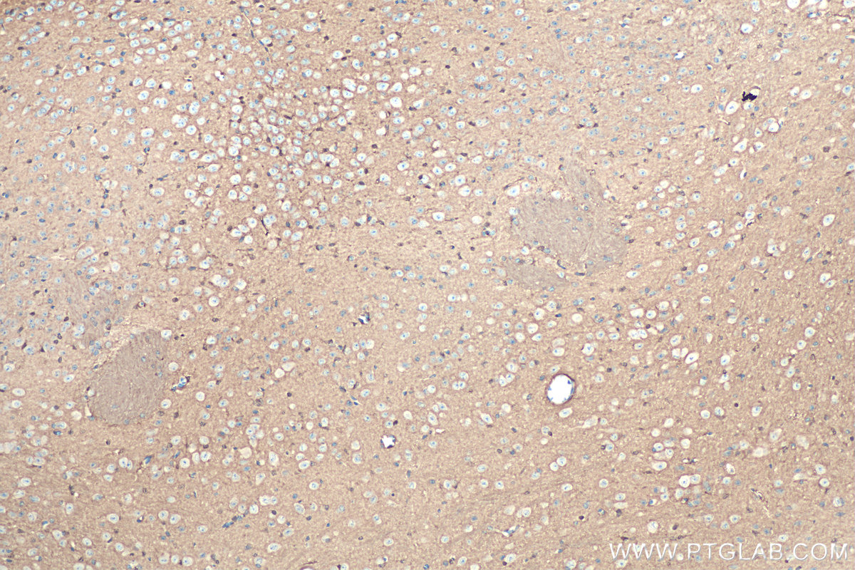 IHC staining of mouse brain using 30108-1-AP