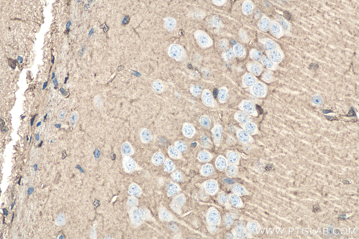 IHC staining of mouse brain using 30108-1-AP