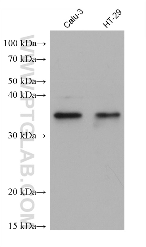 WB analysis using 68823-1-Ig