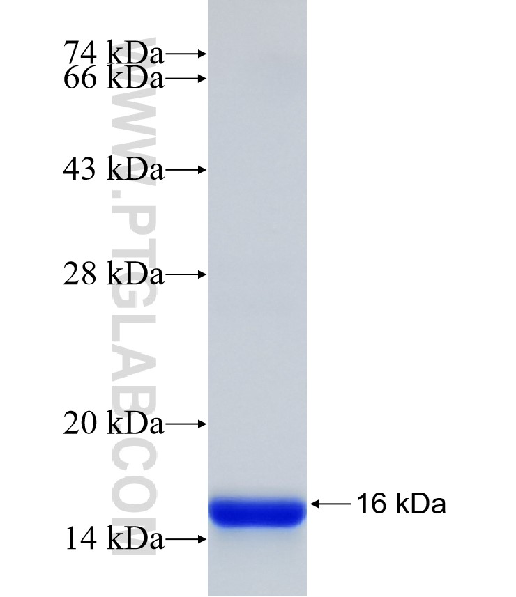 DDAH1 fusion protein Ag32840 SDS-PAGE