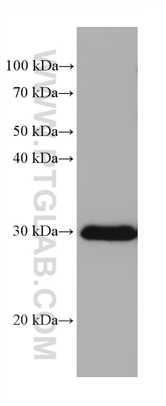 WB analysis of rat colon using 68154-1-Ig (same clone as 68154-1-PBS)