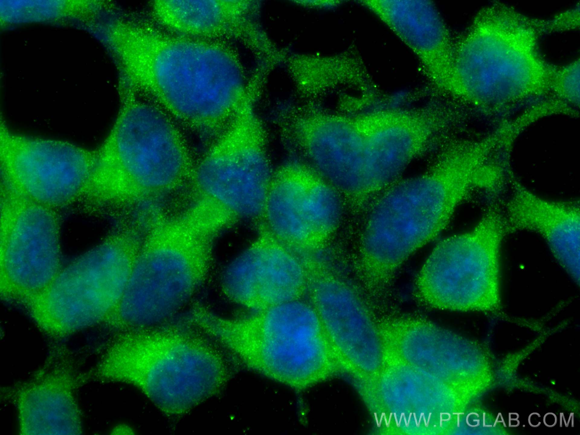 IF Staining of HEK-293 using 25203-1-AP