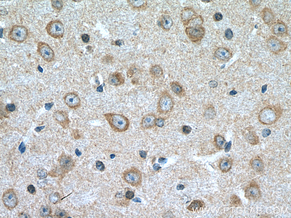 IHC staining of mouse brain using 25203-1-AP