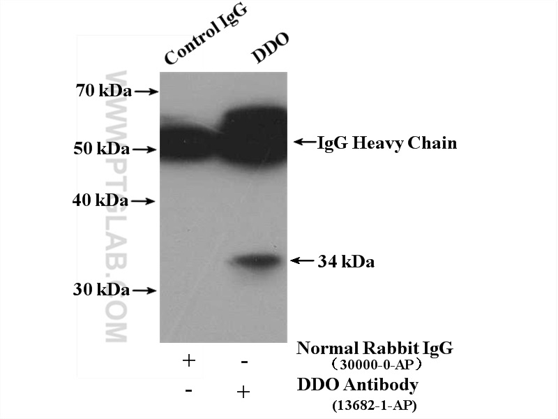 IP experiment of SKOV-3 using 13682-1-AP